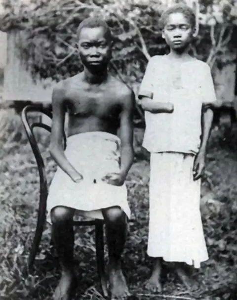 Getty Images Colonial officials amputated and mutilated Congolese people, including children, as punishment